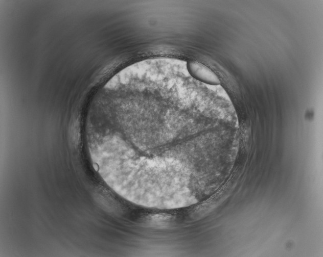 X0000116510158201001201452