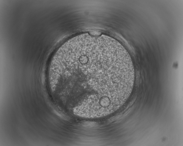 X0000116510203201001201452