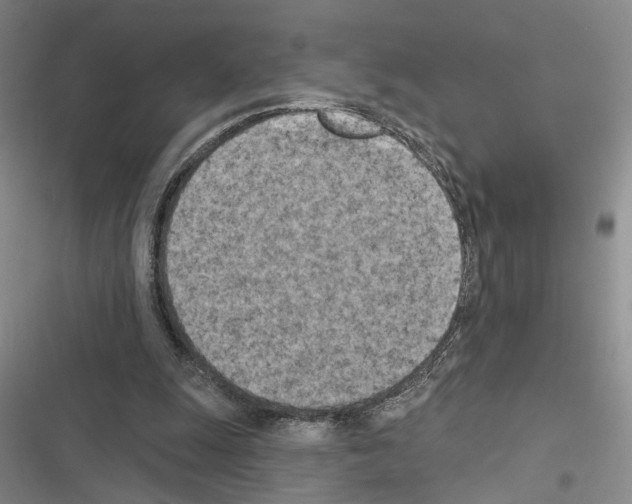 X0000116510247201001201451
