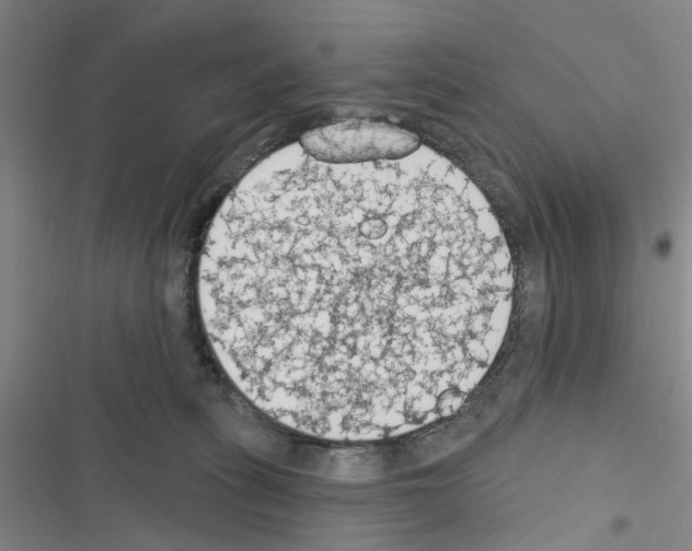 X0000116510275201001201451
