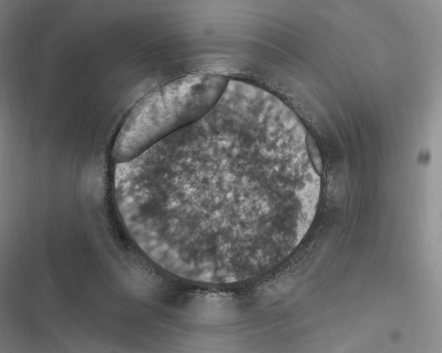 X0000116510304201001201451