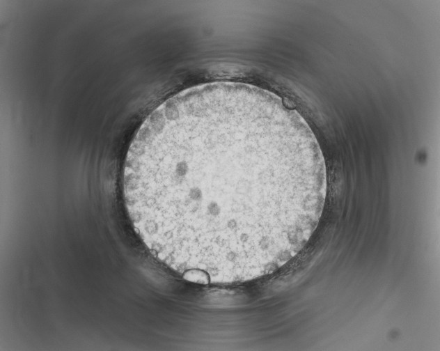 X0000116510315201001201450