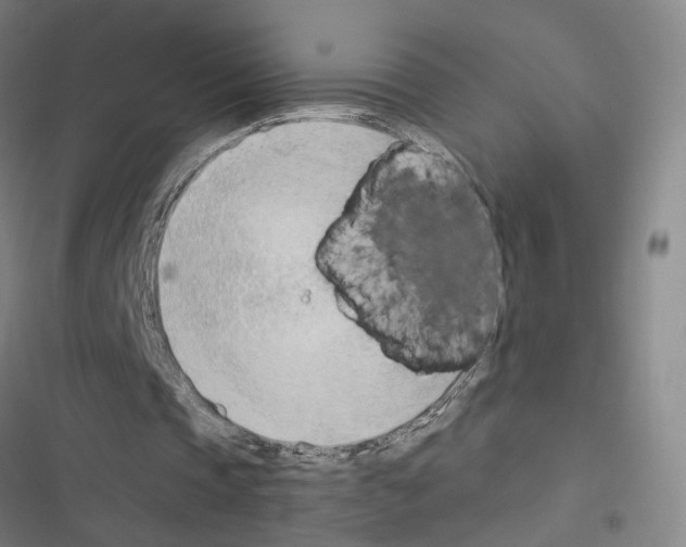 X0000116510337201001201449