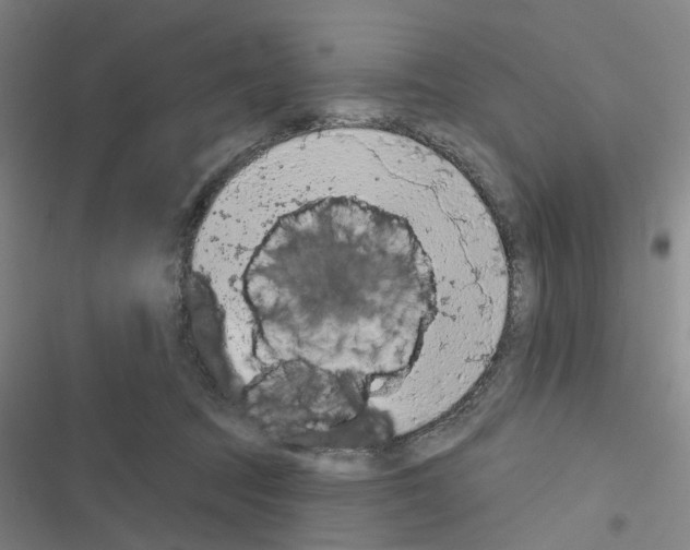 X0000116510369201001201450