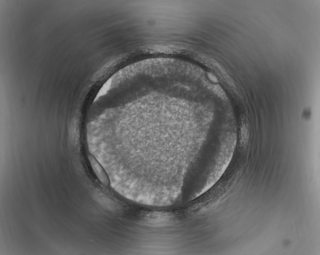 X0000116510444201001201448