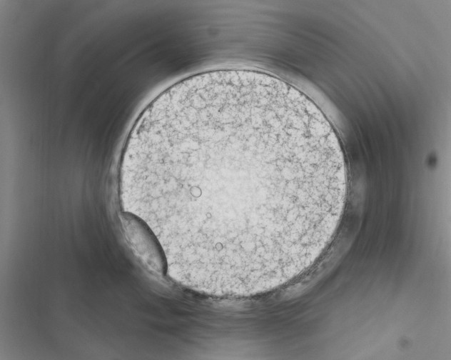 X0000116511004201001201441