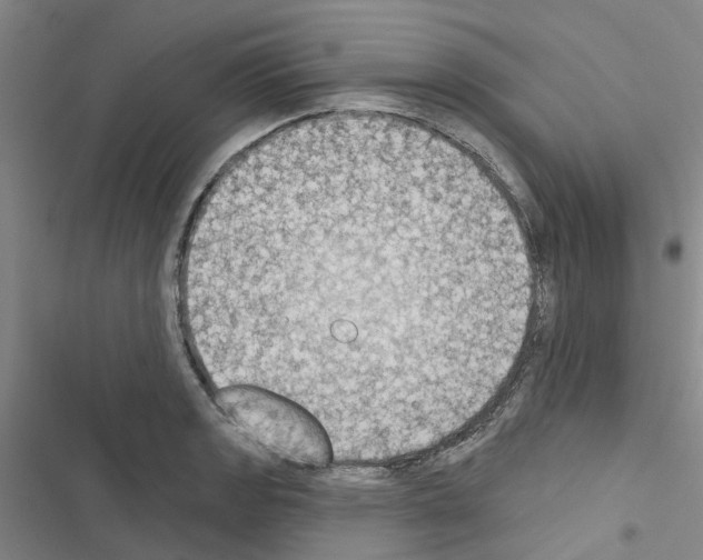 X0000116511133201001201439