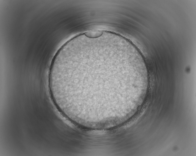 X0000116511134201001201439
