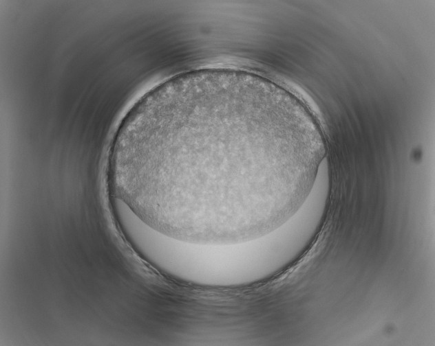 X0000116511138201001201439