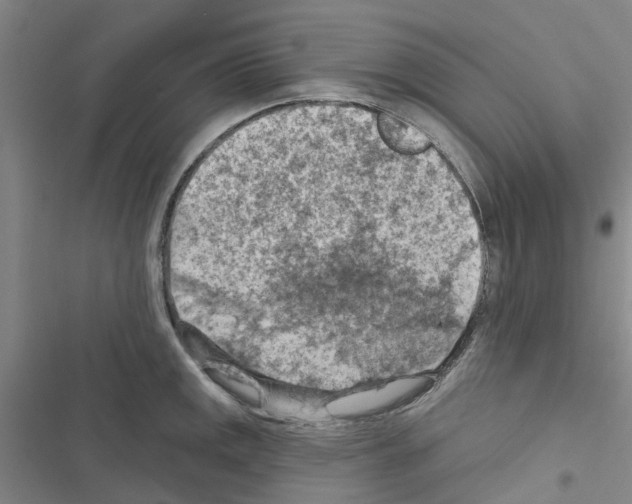 X0000116511141201001201440