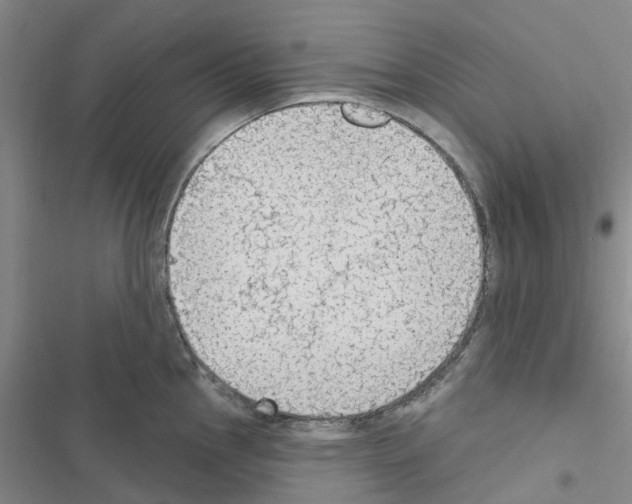 X0000116511145201001201440