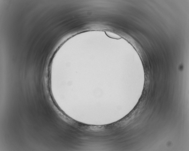 X0000116511147201001201440