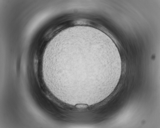 X0000116511151201001201440