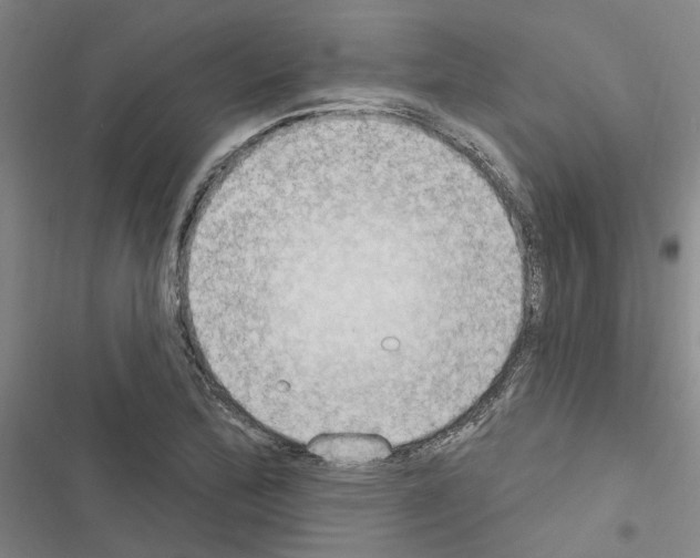 X0000116511172201001201439