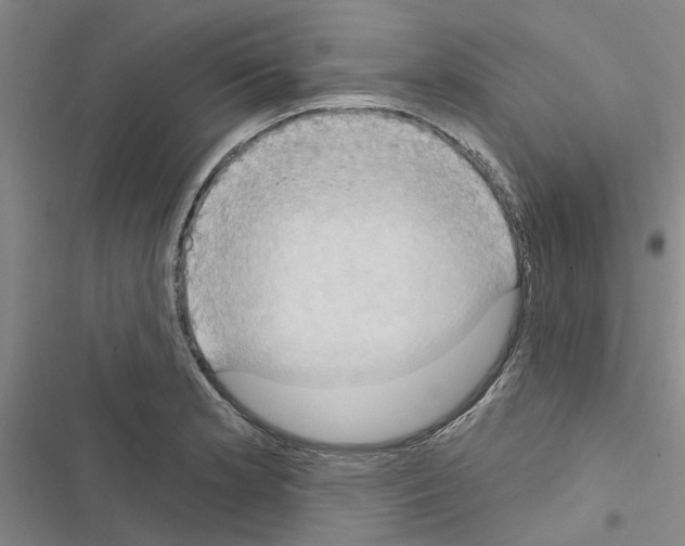 X0000116511181201001201439