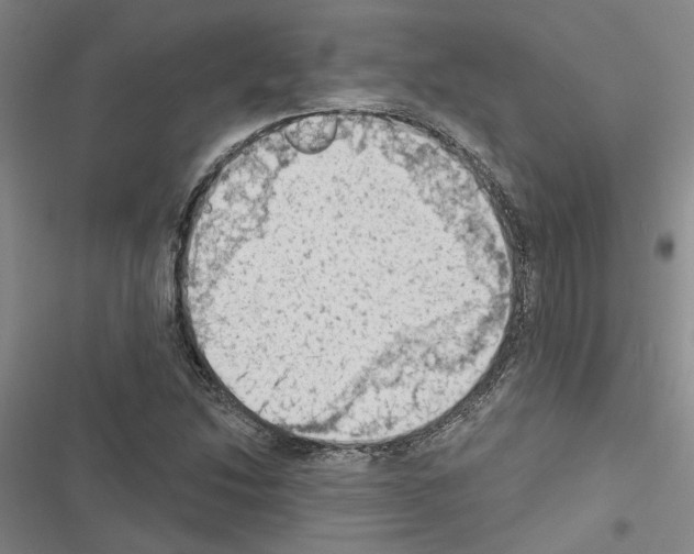 X0000116511214201001201438