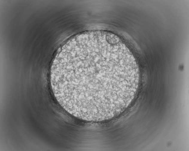 X0000116511217201001201438
