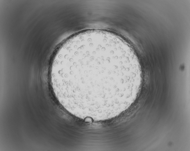 X0000116511315201001201437