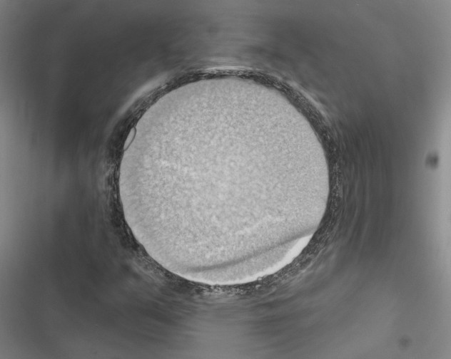X0000116511351201001201436