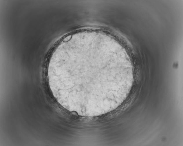 X0000116511352201001201436