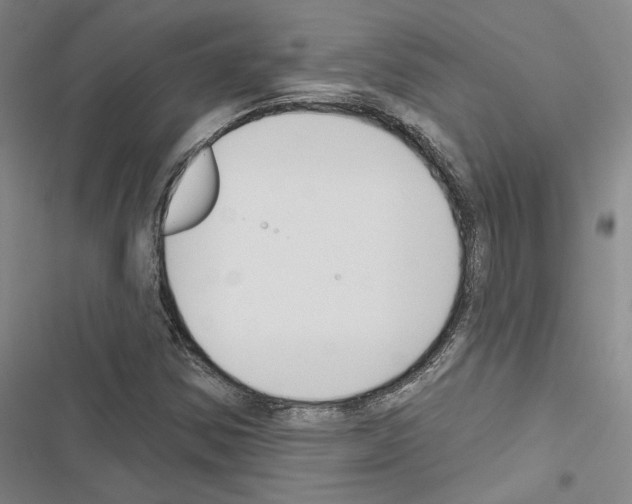 X0000116511354201001201436