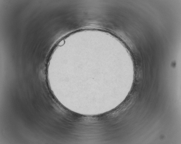 X0000116511356201001201436