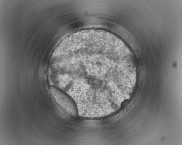 X0000116511377201001201436