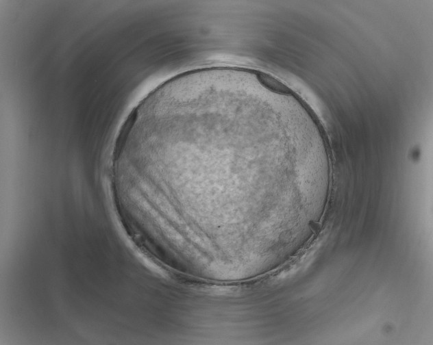 X0000116511381201001201436