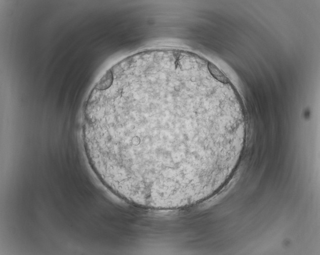 X0000116511390201001201436