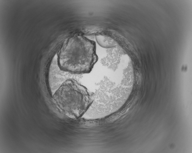X0000116511393201001201435