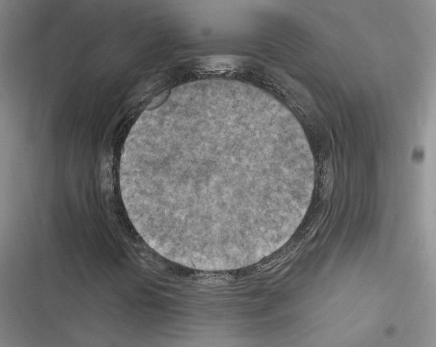 X0000116511394201001201435