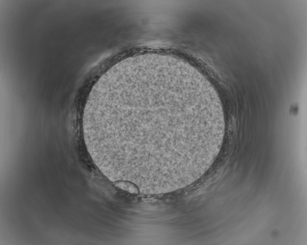 X0000116511398201001201435