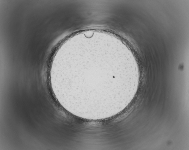 X0000116511406201001201435