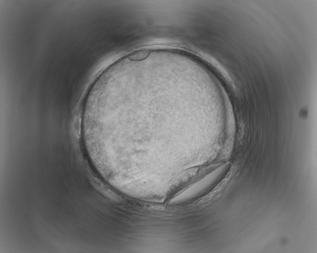 X0000116511413201001201435