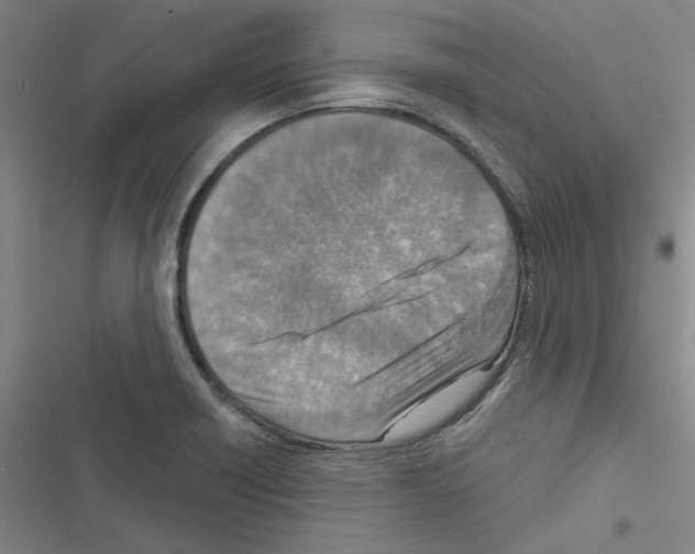 X0000116511418201001201435