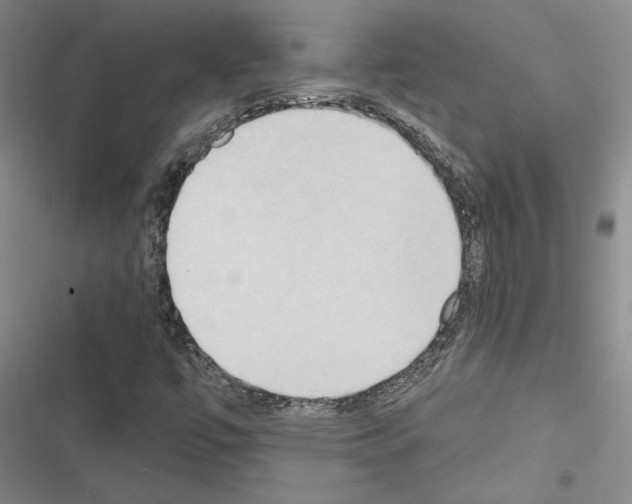 X0000116511447201001201435