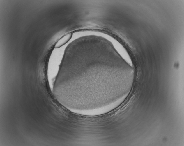 X0000116511455201001201435