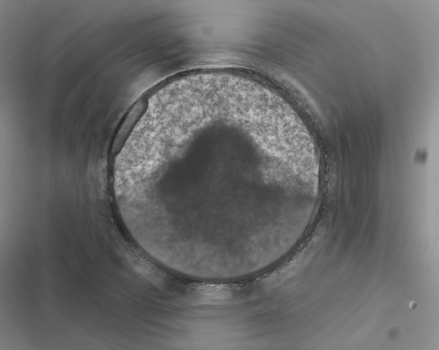 X0000116511457201001201435