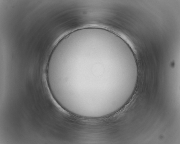 X0000116511476201001201435
