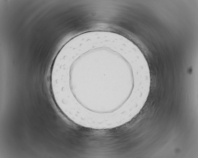 X0000116511479201001201435