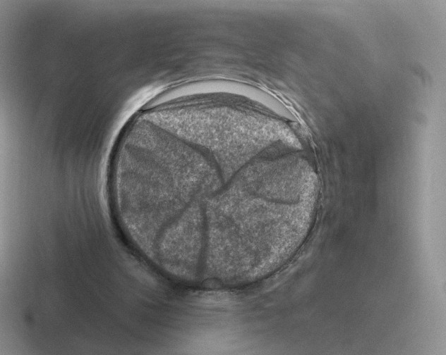 X0000116550104201001071123