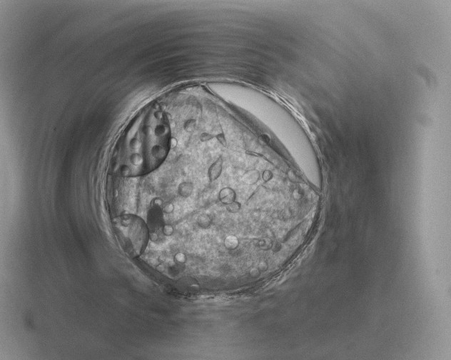 X0000116550145201001071122