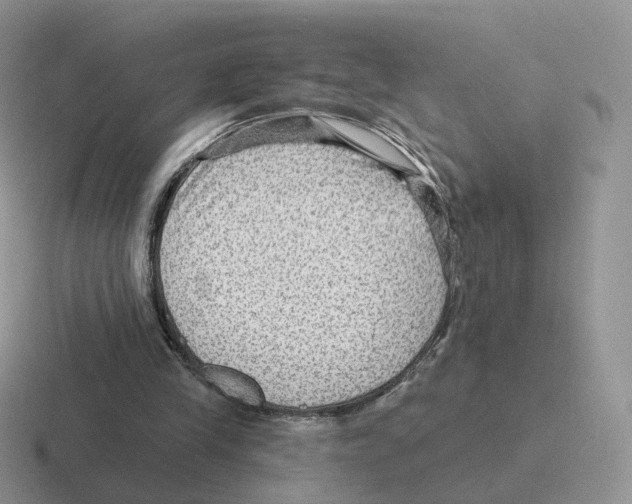 X0000116550245201001071121