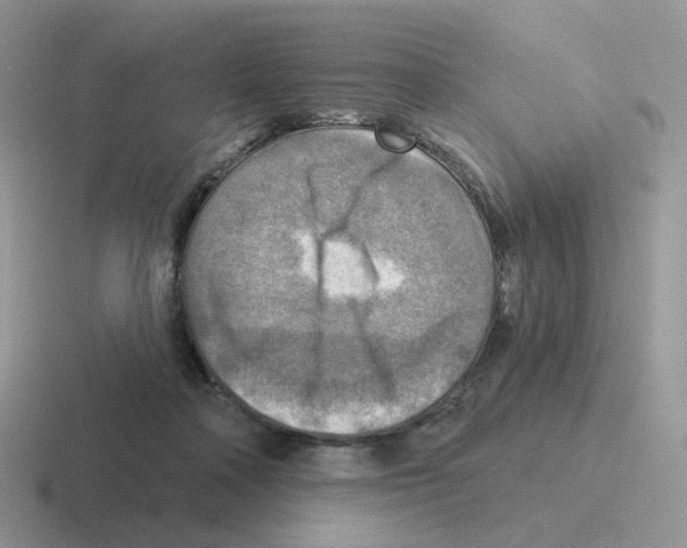 X0000116550314201001071121