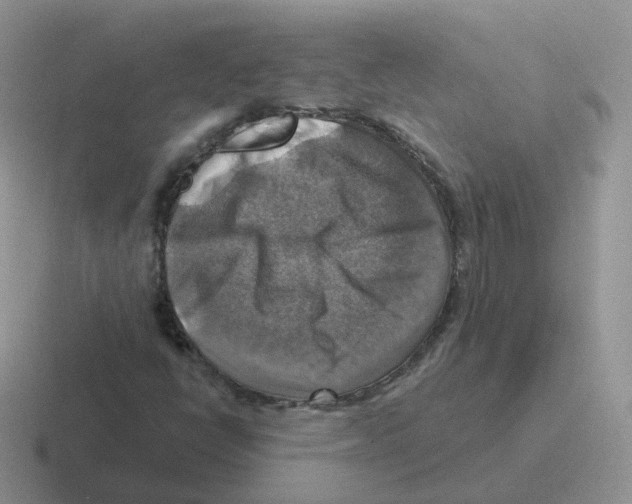 X0000116551398201001071107