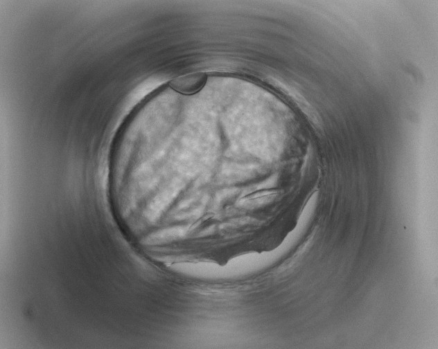 X0000116551418201001071107