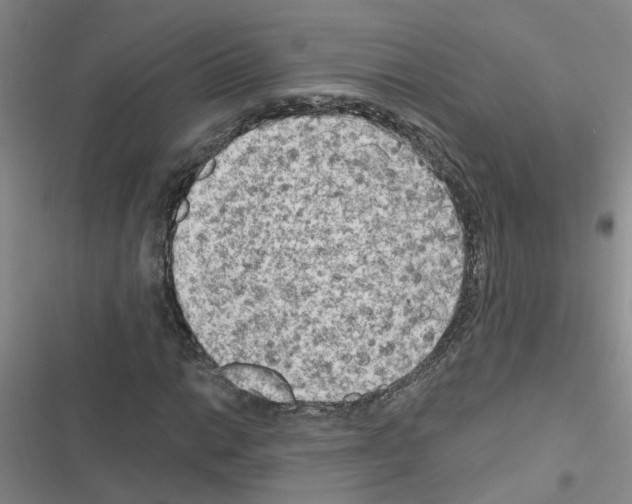 X0000116551014201001211157