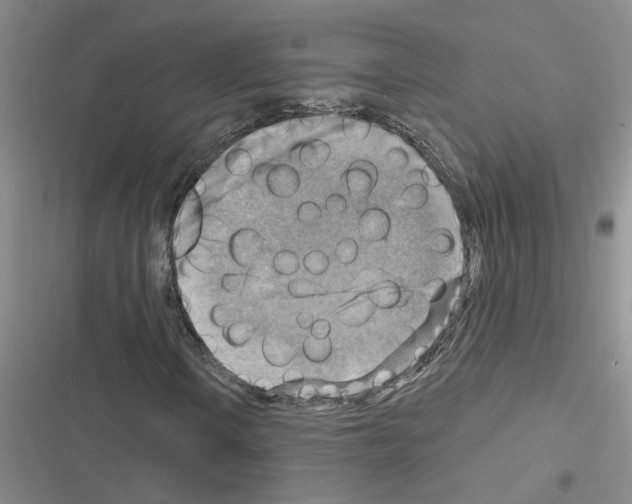 X0000116551106201001211156