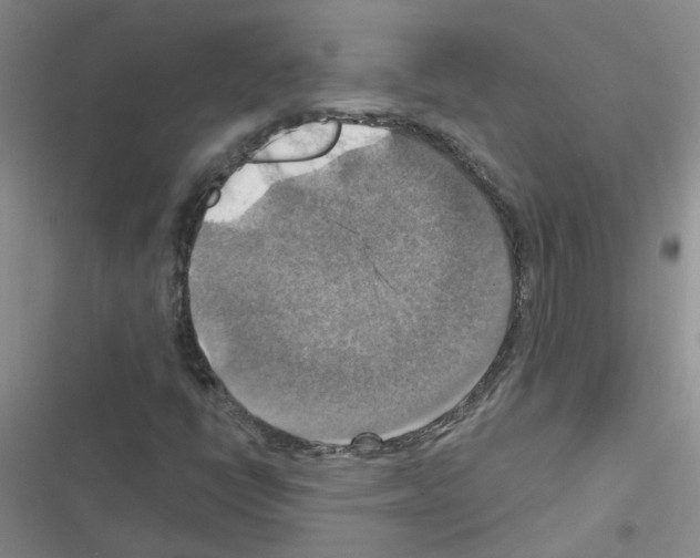 X0000116551398201001211152