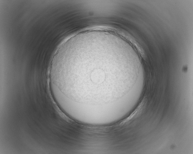 X0000116551417201001211152